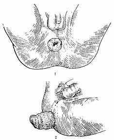 63_111202153737_1.jpg