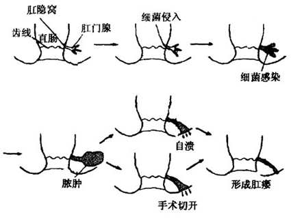 86cb2037e63e33dbc3c70b43bfc5205a.jpg