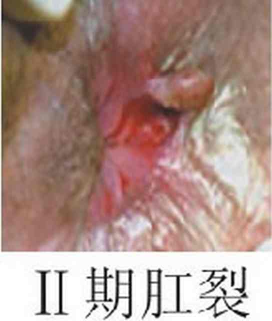“东大19120gc.jpg”