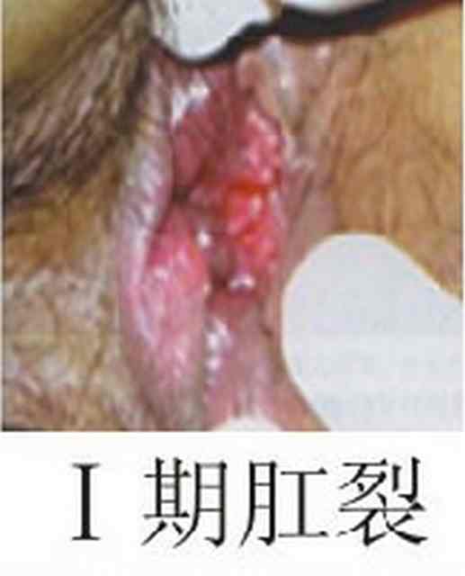 “东大18120gc.jpg”