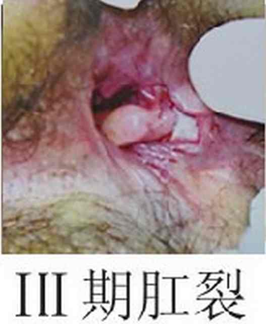 “东大20120gc.jpg”