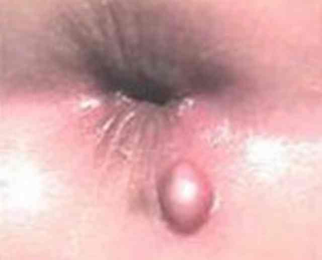1_111104093622_1.jpg