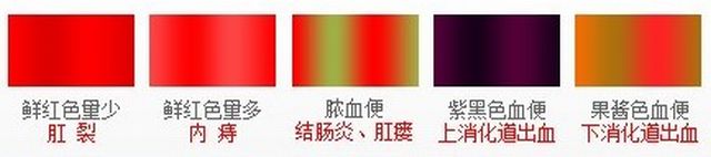 便血颜色辨认.jpg