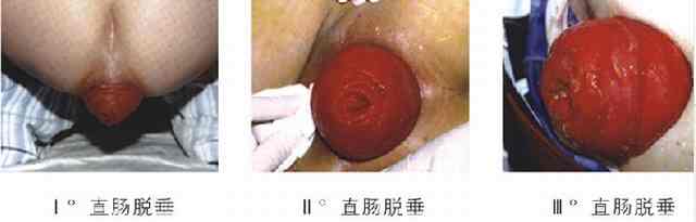 东大13120gc.jpg
