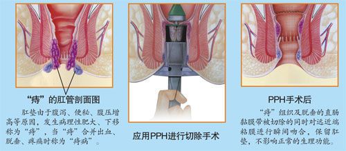 [URL]3f4be92f3dca47adba068c1270869e18.jpg