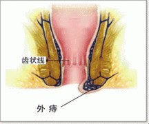 [URL]530e94f574e0afb40cf85fe777b5689b.gif