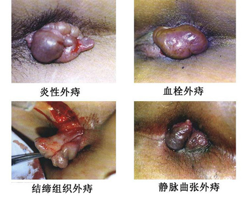 4种类型.jpg