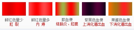 便血颜色图.jpg
