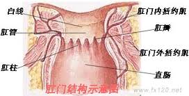 肛瘘1.jpg