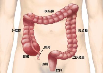 直肠息肉3.jpg