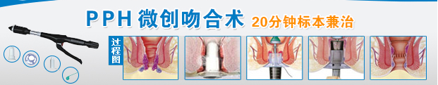 PPH治疗流程1.jpg