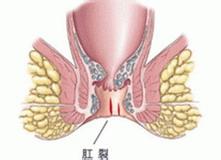 u=248575635,814539874&fm=23&gp=0.jpg