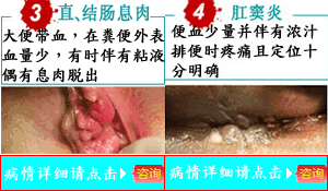 11.gif