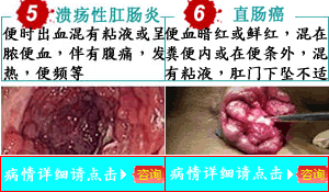 12.gif