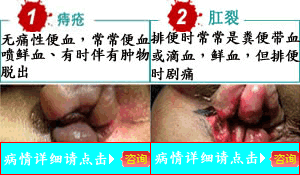 10.gif