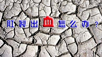 肛裂的治疗