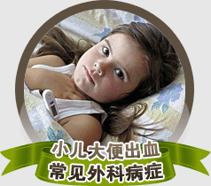 小儿大便出血